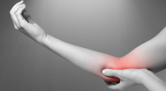 Arm Pain